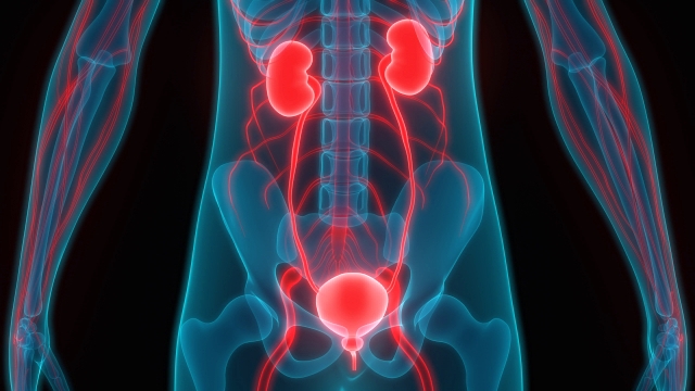 îmbolnăvirilor urinare postura pentru artroza articulației șoldului